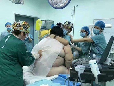 動用16名醫護！127公斤孕婦「最驚險生產」　卻遭酸：老公眼光差