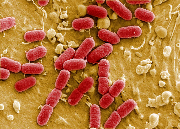 超級細菌,Superbugs （圖／路透社）