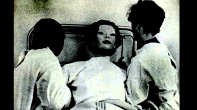 醫院來了「木偶般的女人」…只有一個目擊者活著見證診療過程