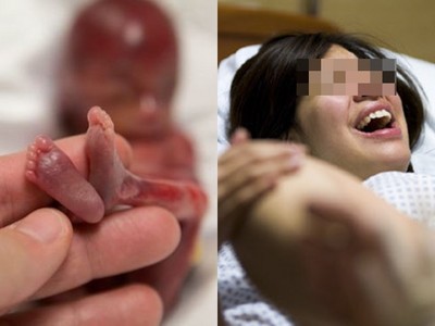 流產死胎都去哪了？港婦淚控：15周胎被當「寵物屍」不能領回