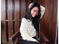 女孩黑痣爬滿臉到腳（圖／翻攝自網IG）