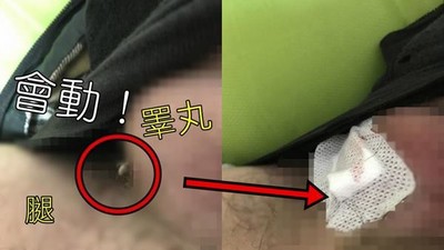 他睪丸長「蛆狀粉刺」　PO網才知壁蝨鑽蛋...差點往生