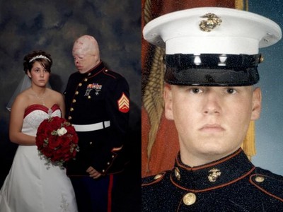 女友嫁給毀容士兵「全程沒笑容」　婚姻只撐一年就散伙