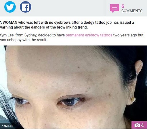 紋眉失敗，雪梨華裔女成了無眉女。（圖／翻攝自太陽報／Kym Lee）