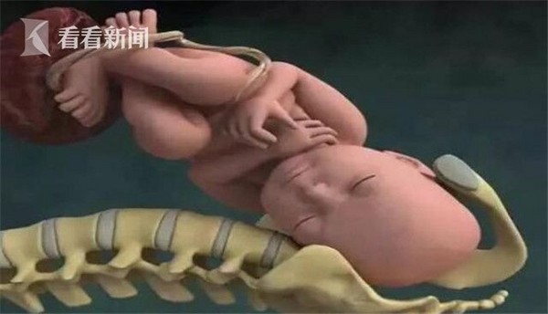 ▲▼ 江蘇一名男嬰在媽媽肚子裡讓臍帶扭轉61圈。（圖／翻攝《看看新聞》）