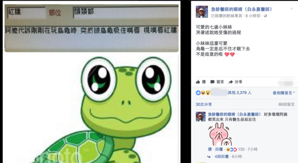 ▲女童「嘴唇紅腫」掛急診 阿嬤說:烏龜...急診醫全笑瘋。(圖/翻攝急診醫師的眼睛(白永嘉醫師))