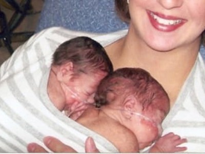 雙胞胎1倖活1垂死！護理師一個違規舉動，讓人看見生命奇蹟