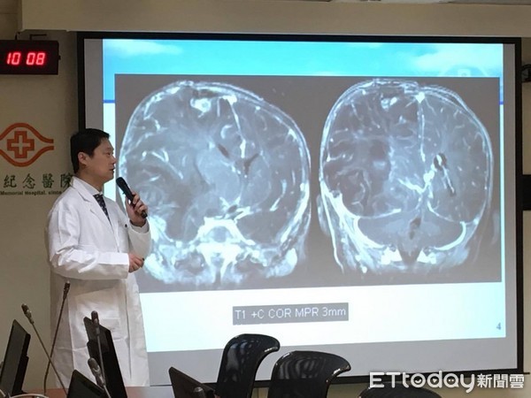 ▲兒虐6成是腦傷,存活者1/4變重殘。(圖/記者嚴云岑攝)