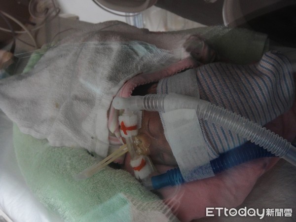 ▲蘇巧慧二女兒是早產兒。(圖/蘇巧慧提供)