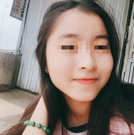 ▲14歲妹充iPhone6遭電死　手握「貼膠充電線」白豆腐裂開。（圖／翻攝臉書）