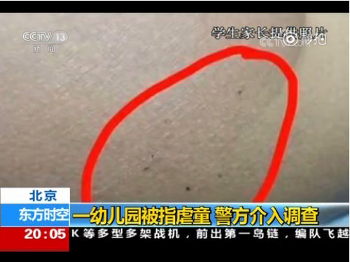 ▲▼北京市朝陽區管莊的紅黃藍幼兒園近日爆出虐童事件。（圖／翻攝自央視新聞）