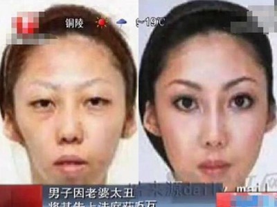 瞞不住！女兒「醜到不像親生」妻認婚前整形…夫家怒告詐欺