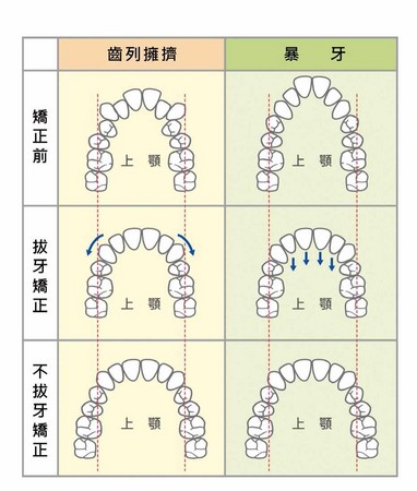 ▲▼一張圖看牙齒對身體器官的影響。（圖／時報出版授權提供）