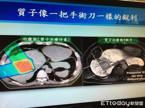 ▲林口長庚質子治療。(圖/記者嚴云岑攝)