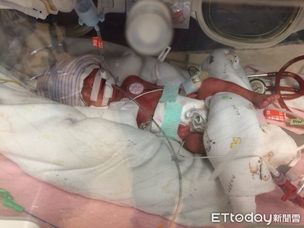 ▲國泰早產兒。(圖/記者嚴云岑攝)
