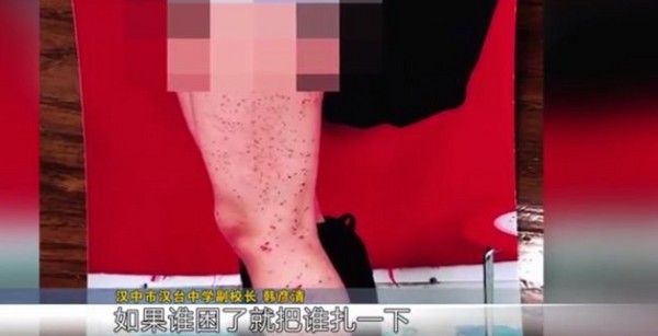▲▼陝西女生被同桌扎得滿腿是血。（圖／翻攝自中國青年網）