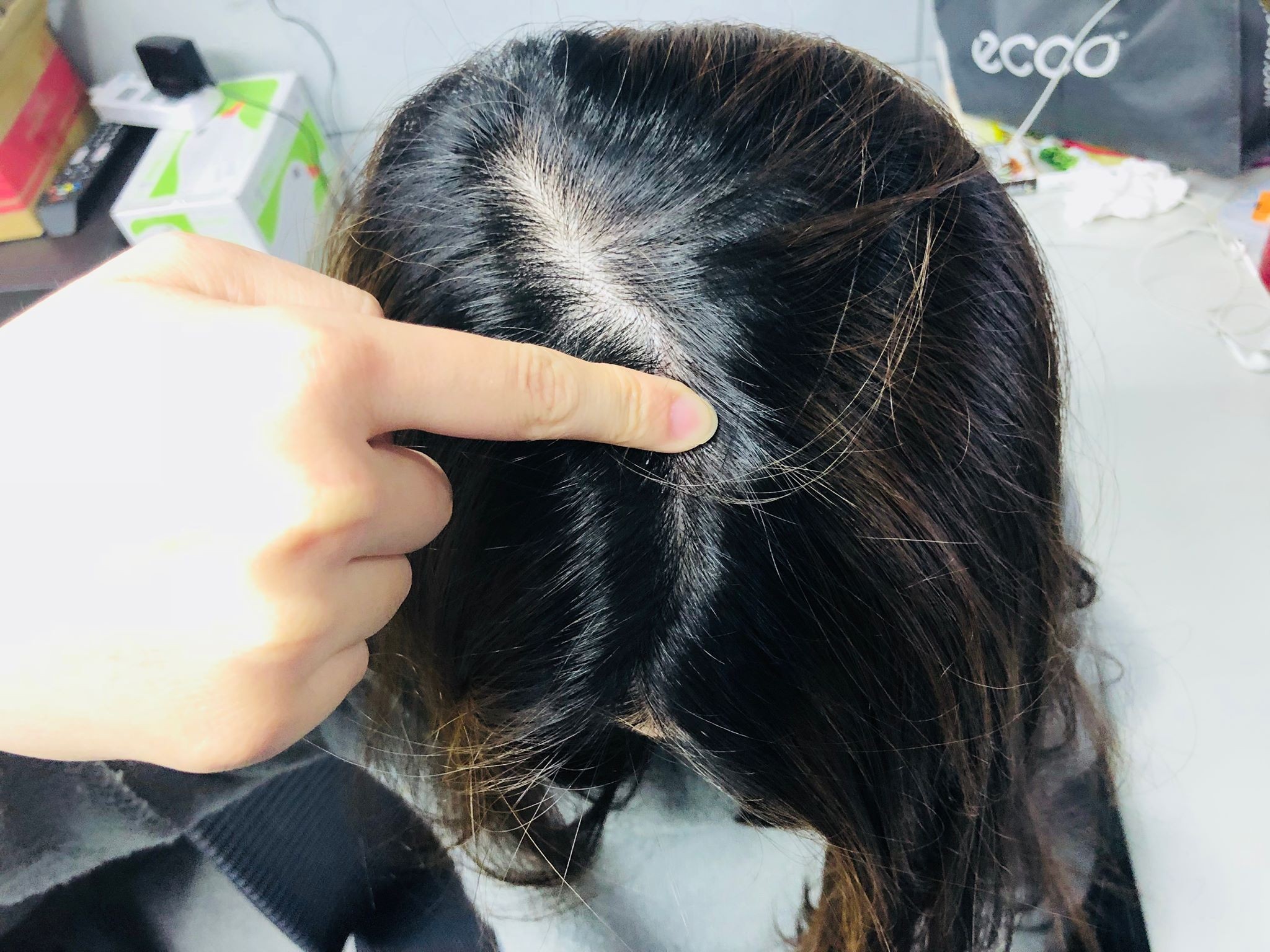 ▲百會穴。(圖/記者曹悅華攝)