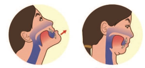 ▲《矯正可以不拔牙》書摘圖。(圖/時報出版提供)