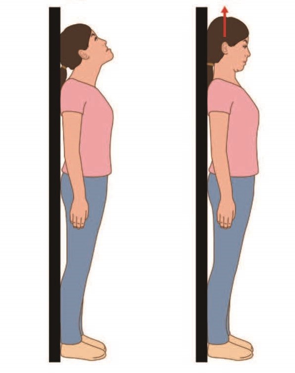 ▲《矯正可以不拔牙》書摘圖。(圖/時報出版提供)