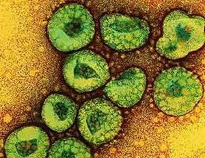 世界衛生組織(WHO)23日將最近爆發的新型冠狀病毒感染命名為「中東呼吸綜合症」(Middle East Respiratory Syndrome，MERS)，該病毒與「嚴重急性呼吸道綜合症」(SARS)同科。(圖／取自中國經濟新聞網)