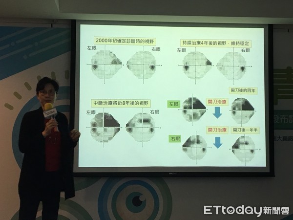 ▲青光眼治療 。(圖/記者嚴云岑攝)