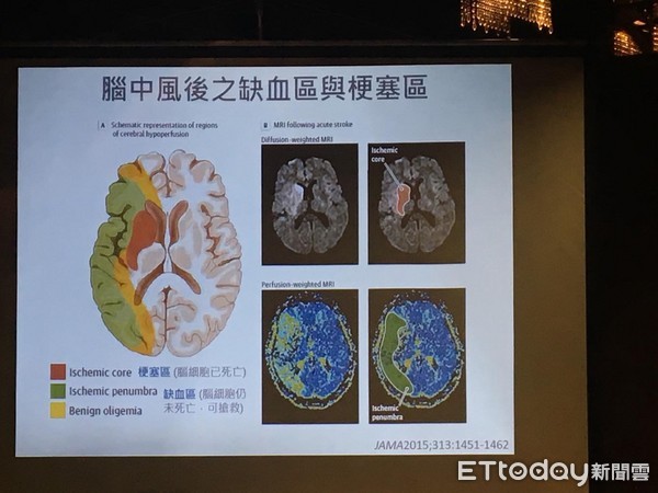 ▲腦中風醫學會。(圖/記者嚴云岑攝)
