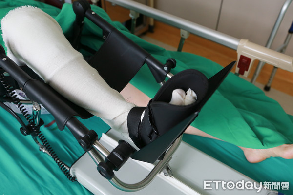 ▲膝關節復健,復健,復健療程,手術復健。(圖/記者林世文攝)