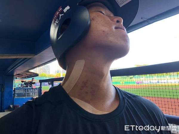 ▲廖健富的傷勢已無大礙 。(圖/記者王真魚攝)