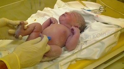 懷孕35週至醫院引產　護士救活嬰兒送不孕夫妻　生母怒索賠拐嬰費