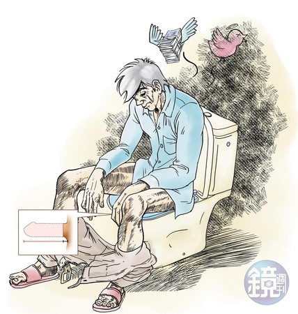 王姓男子攝護腺開刀後性功能不佳,裝人工陰莖後卻整支爛掉,切到只剩1公分,只能坐著尿尿。