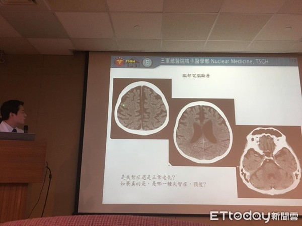 ▲失智症正子檢測。(圖/記者嚴云岑攝)