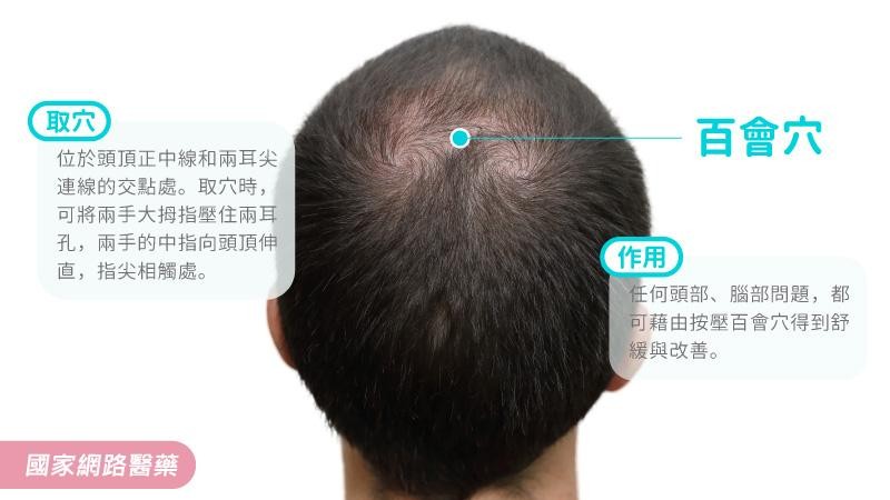 ▲kingnet中醫教你預防季節性掉髮。(圖/國家醫藥提供)