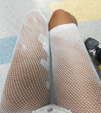 ▲▼謝姓女舞者遭鞭炮炸傷。(圖/翻攝當事人臉書)