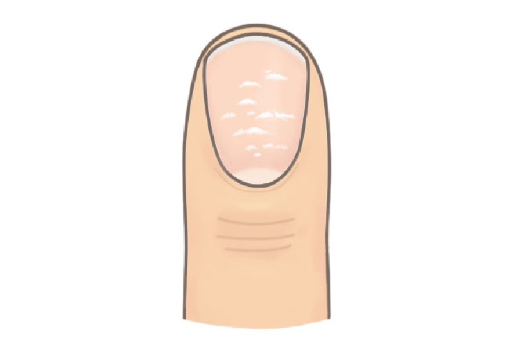 ▲指甲給的健康報告書摘圖。(圖/大塊文化提供)