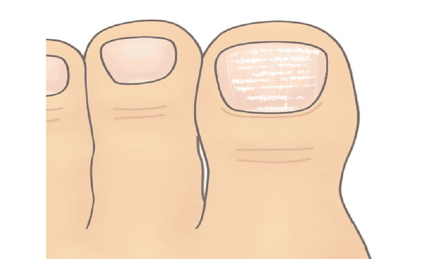 ▲指甲給的健康報告書摘圖。(圖/大塊文化提供)