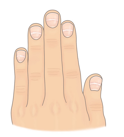 ▲指甲給的健康報告書摘圖。(圖/大塊文化提供)