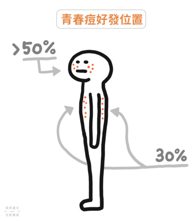 ▲痘痘,面皰,ihealth政昇藥局。(圖/ihealth提供)