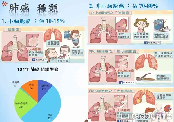 ▲郭綜合醫院放射腫瘤科陳紘玉主任指出，透過新式4D電腦斷層模擬定位，讓肺癌放射治療更精準有效。（圖／記者林悅攝）