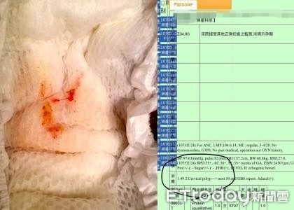 ▲顧可飛假性月經。(圖/廖小姐提供)