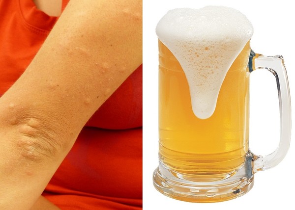 ▲愛喝酒會被蚊子叮上。(圖/取自免費圖庫pixabay)