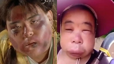 山上蜜蜂有點兇！　中國大媽「腫得面目全非」想討拍卻讓人笑翻