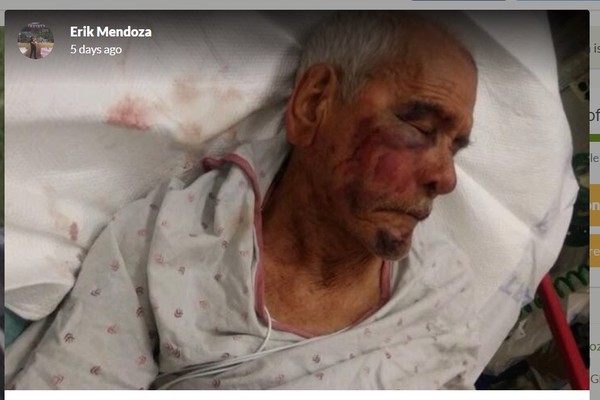 ▲▼91歲的墨西哥阿公在美國街頭被打成重傷。（圖／翻攝自gofundme網站）