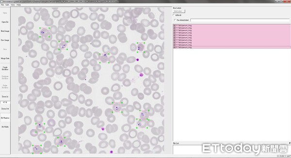 ▲瘧原蟲標記畫面。(圖/疾管署提供)