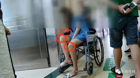 ▲▼女子醉臥路邊被人帶到酒店後自稱失憶身上有瘀青。(圖/翻攝澎湃新聞)