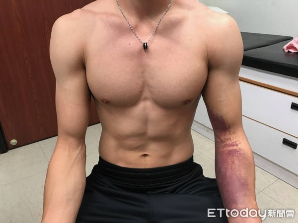 ▲李智凱克服肩傷 用意志力短期復原。(圖/長庚醫院提供)