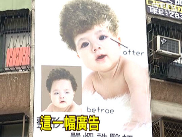 ▲▼嬰兒割雙眼皮廣告,恐違反醫療法挨罰。(圖/東森)