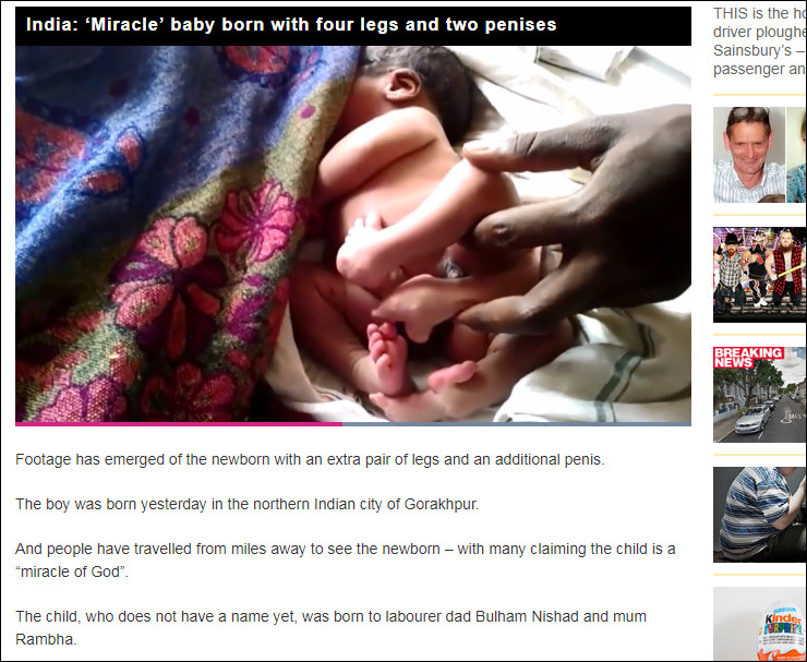 ▲印度北方邦城市戈勒克布爾（Gorakhpur）一名孕婦產下了4條腿的男嬰。（圖／翻攝自每日星報）