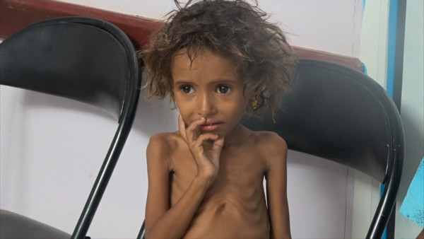 ▲▼葉門戰火狂轟幼童飢荒。（圖／翻攝自AP影片）