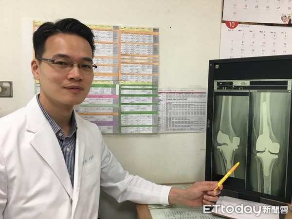 ▲▼八旬嬤人工關節斷裂。(圖/南投醫院提供)