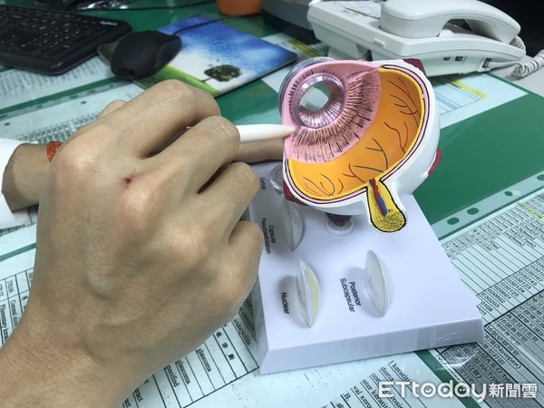 ▲▼3天飆70集《延禧攻略》!35歲女狂追劇...竟提前得老花眼。(圖/烏日林新醫院提供)